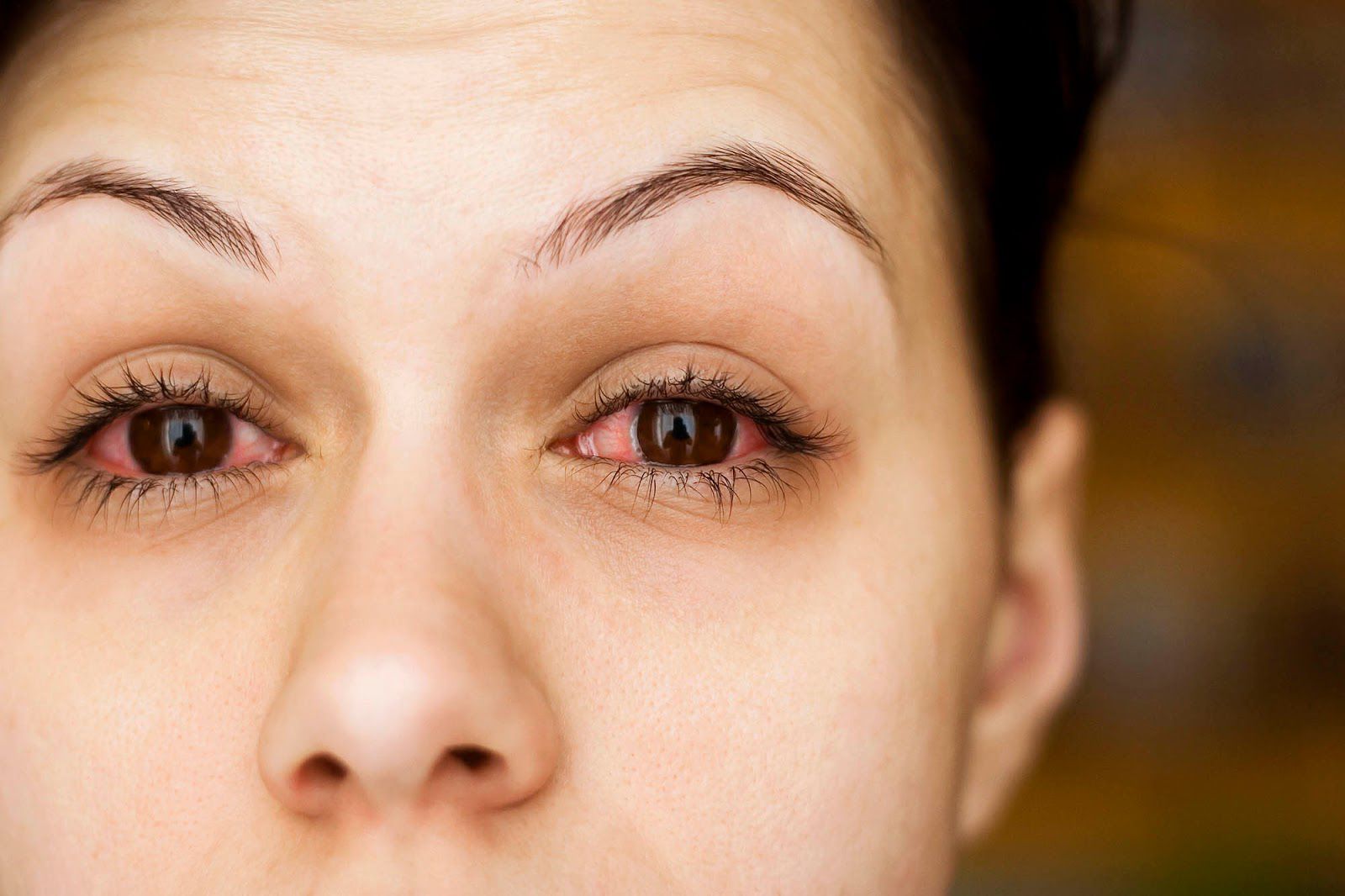 Bà bầu bị đau mắt đỏ cần kiêng gì?