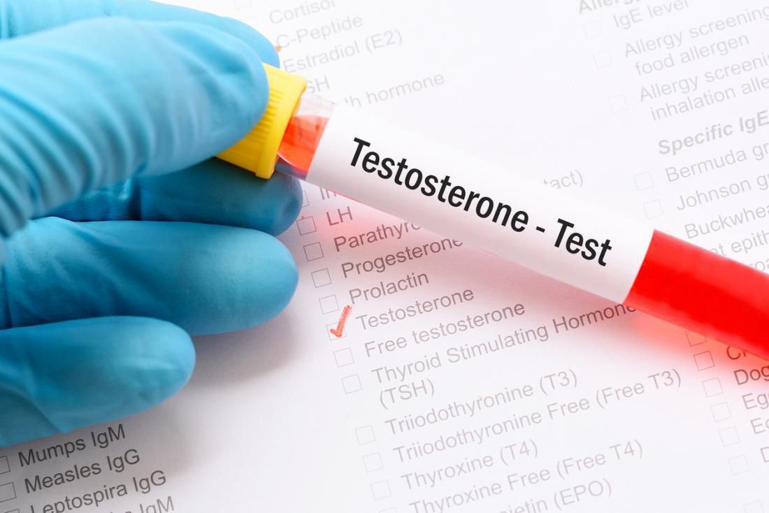 Điều trị hội chứng suy giảm Testosterone ở nam giới 2