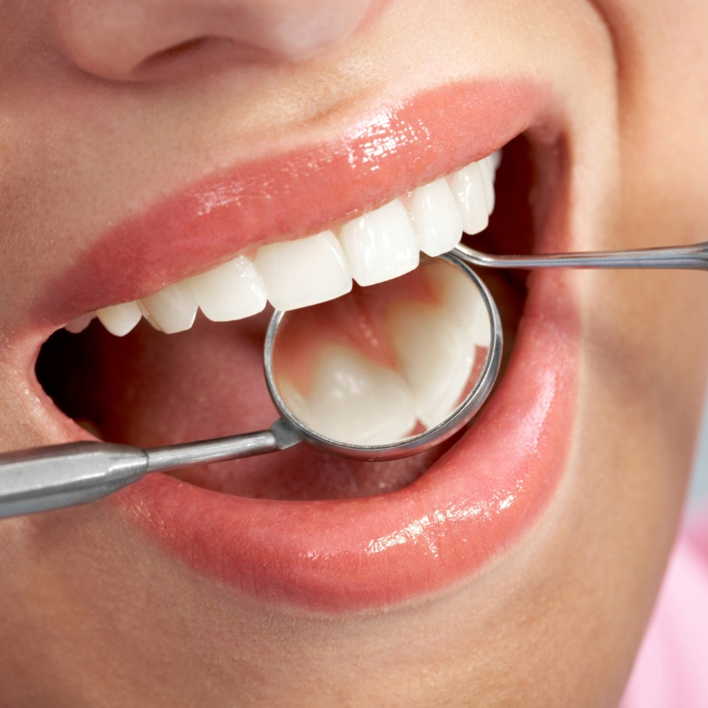 KIN Gingival thương hiệu chăm sóc răng miệng, ngừa viêm nướu hiệu quả